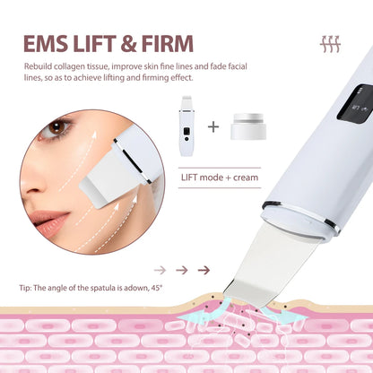 Ultrasonic Skin Scrubber & Blackhead Remover
